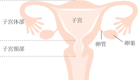 四球の図。上部：子宮体部、下部：子宮頸部、上部右側：子宮・卵管・卵巣